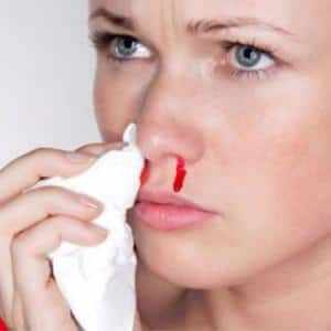 -алгоритм остановки носового кровотечения