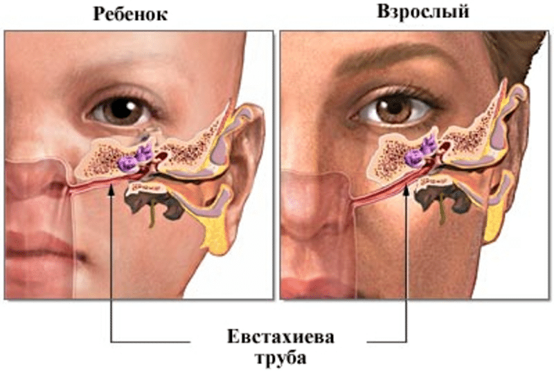 воспаление уха у ребенка лечение