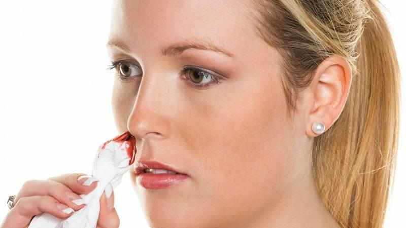 кровь из носа причины у взрослого после высмаркивания