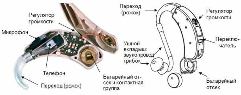 как работает слуховой аппарат