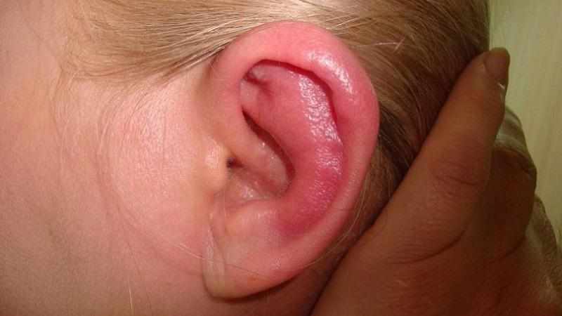 Заболевания органов слуха