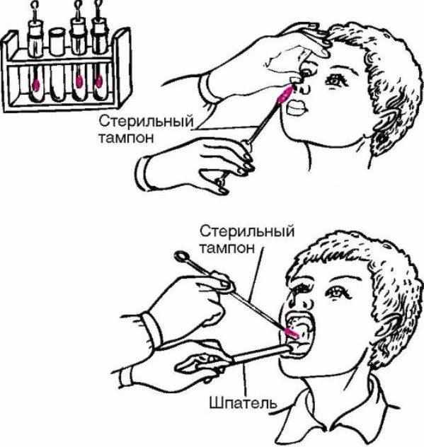 анализ из носа на стафилококк