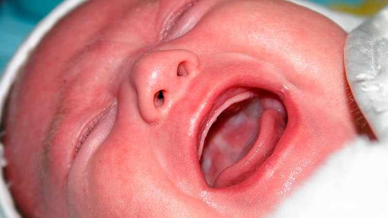 Как лечить красное горло у ребенка
