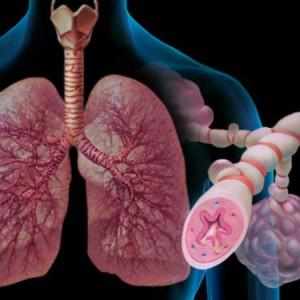 Как лечить аллергическую бронхиальную астму