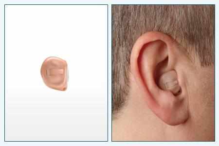 современные слуховые аппараты внутриушные цены