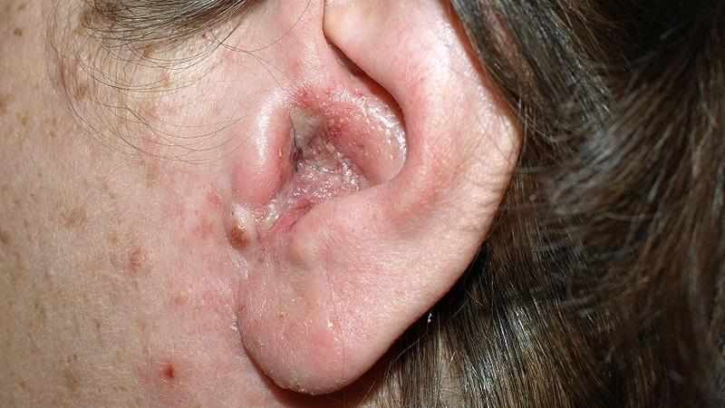 Какие заболевания уха бывают