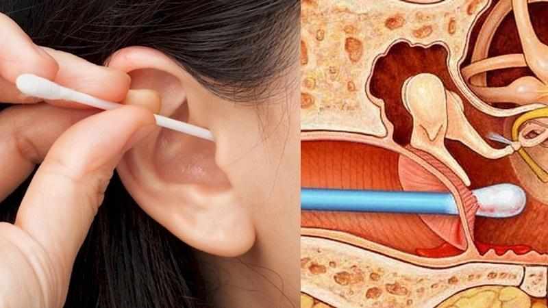 гнойный отит среднего уха у взрослых лечение