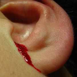 Почему из уха идет кровь