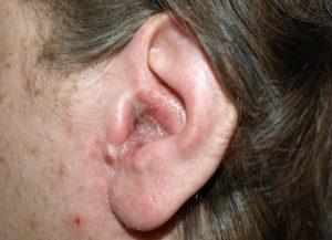 Почему болит при нажатии за ухом