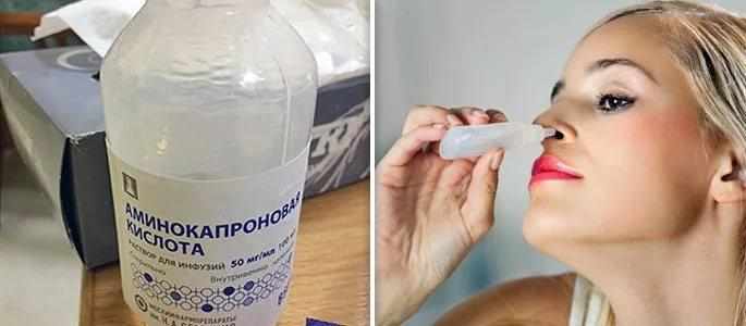 как промывать нос аминокапроновой кислотой детям и взрослым