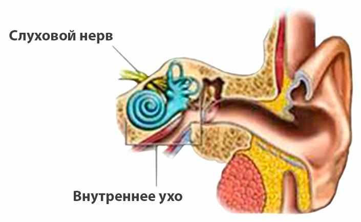 -лечение неврита слухового нерва